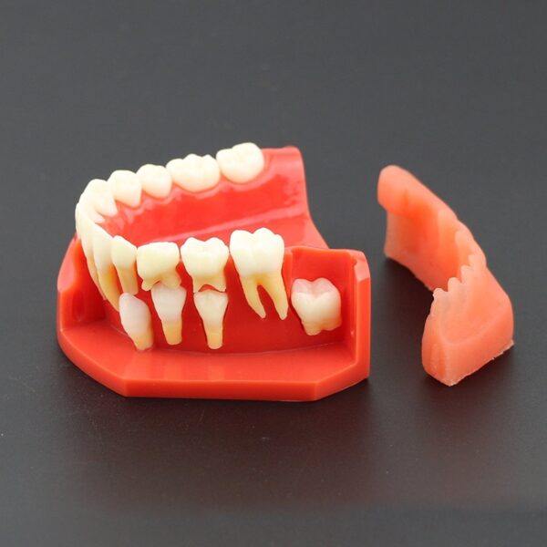 Dentalmall 1 Pc Modelo Dental # 4006 01 - Erupción (f) - Image 6