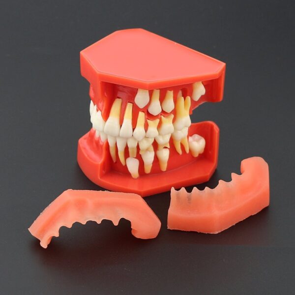 Dentalmall 1 Pc Modelo Dental # 4006 01 - Erupción (f) - Image 3