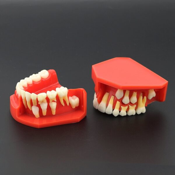 Dentalmall 1 Pc Modelo Dental # 4006 01 - Erupción (f) - Image 4