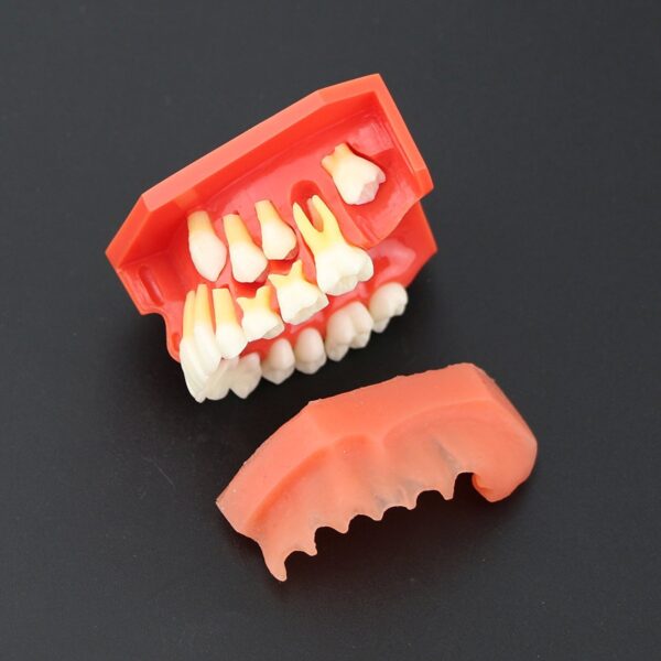Dentalmall 1 Pc Modelo Dental # 4006 01 - Erupción (f) - Image 5