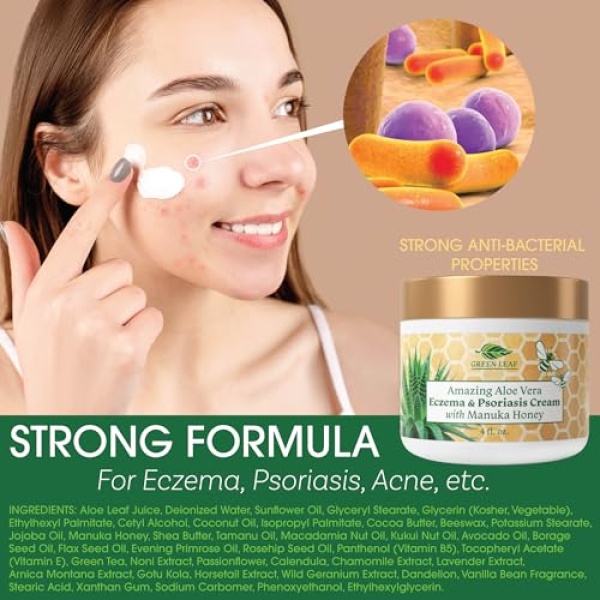 Amazing Aloe Vera Eczema and Psoriasis Cream with Manuka Honey by Green Leaf Naturals - 4 oz - Image 3