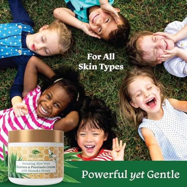 Amazing Aloe Vera Eczema and Psoriasis Cream with Manuka Honey by Green Leaf Naturals - 4 oz - Image 6