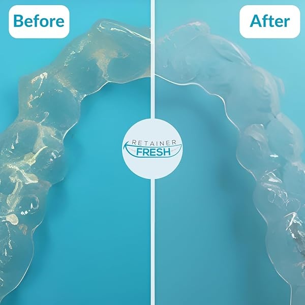 Cleaning Tablets - 120 Tablets 4 Months Supply Retainer Fresh Keeps Retainers Clean, Fresh, Bright, and Stain-Free - Dentures, Invisible Straighteners, Aligners, and Mouth Guards. - Image 3