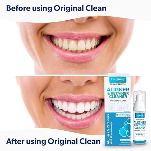 EverSmile AlignerFresh Original Clean - AlignerFresh Cleaning Foam for Invisalign, ClearCorrect, Essix, Hawley Trays/Aligners. Cleans, Eliminates Bacteria, Whitens Teeth & Fights Bad Breath (50ml) - Image 5