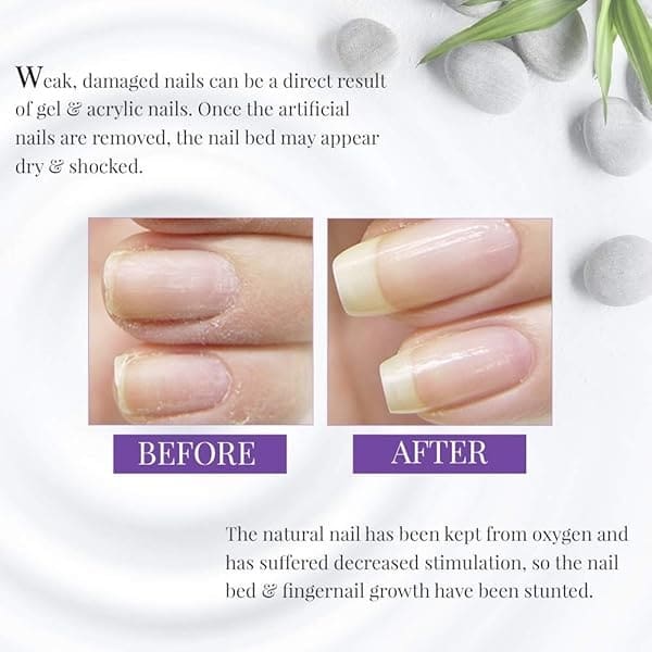 Nail Tek base, capa base de fortalecimiento de relleno Ridge, 2 paquetes, Foundation Xtra 4 for Weak, Damaged Nails - Image 3