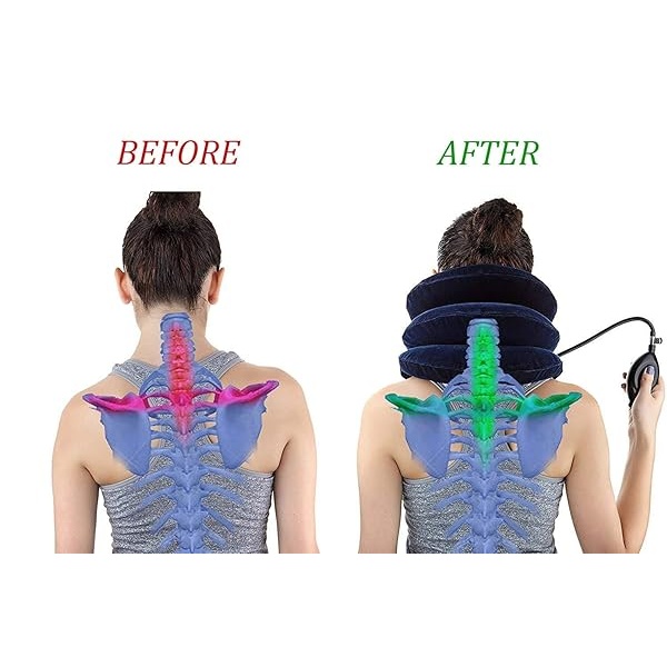 RUNZI Dispositivo de tracción cervical para cuello inflable, fácil de usar para aliviar el dolor crónico de cuello y hombros, almohada cervical para cuello HOM - Image 4